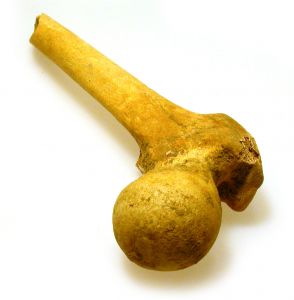 Osso duro de roer
